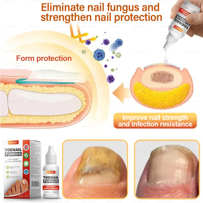✅ Made and shipped from the UK | Zvoevo® Extra Strength Toenail Fungus Treatment, Antifungal Solution for Toenails or Fingernails 🍀